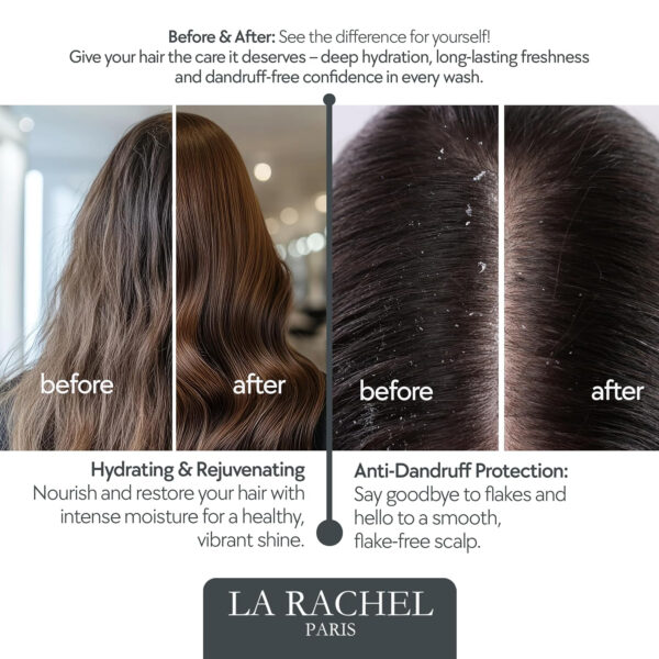 Anti-Dandruff Shampoo with Argan Oil and Keratin | Safe for Dry, Damaged & Color-Treated Hairs | Salt-Free Nourishing Formula for Strength and Shine | Volumizing Shampoo by La Rachel Paris