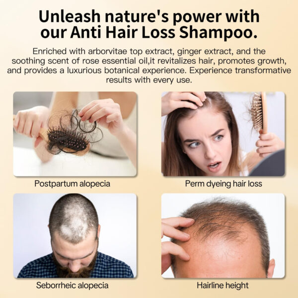 Anti Hair Loss Shampoo,Nourishing Hair Growth Ginger Shampoo for Men & Women - Volumizing Hair Regrowth Treatment infused with Herbal Essences Rose & Castor Oil 16.8 fl. oz