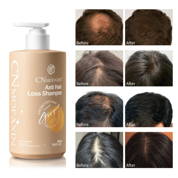 Anti Hair Loss Shampoo,Nourishing Hair Growth Ginger Shampoo for Men & Women - Volumizing Hair Regrowth Treatment infused with Herbal Essences Rose & Castor Oil 16.8 fl. oz