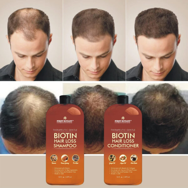 First Botany, Biotin Hair Growth Shampoo Conditioner Anti Hair Loss Thickening formula Collagen & Stem Cell For Hair Regrowth Anti Thinning Sulfate Free For Men Women Anti Dandruff Treatment 16 oz x2