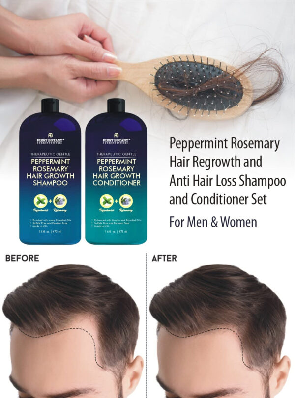 6893176b0dab8ff6f30f3efb8094319bf8543573faa86ba5f827f.jpg First Botany, Peppermint Rosemary Hair Regrowth and Anti Hair Loss Shampoo and Conditioner Set - Daily Hydrating, Detoxifying, Volumizing Shampoo and Fights Dandruff For Men and Women 16 fl oz x 2