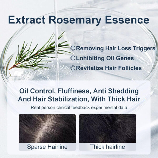 68931901c5a2d1e5e20bff0d7479815e8b7e3909e0a983eb1954c.jpg Organic Biotin & Rosemary Hair Growth Shampoo – Thickening Shampoo with Amino Acids for Hair Loss, Dandruff Control & Oily Scalp - for Women & Men