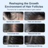 68931904da9a1f428f2a20f03d10f6d4b500ca3116ace78743167.jpg Organic Biotin & Rosemary Hair Growth Shampoo – Thickening Shampoo with Amino Acids for Hair Loss, Dandruff Control & Oily Scalp - for Women & Men