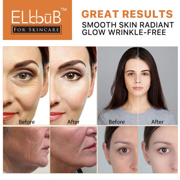 Premium 20% Vitamin C Serum For Face with Hyaluronic Acid, Retinol & Amino Acids - Boost Skin Collagen,Hydrate & Plump Skin, Anti Aging & Wrinkle Facial Serum 60ml