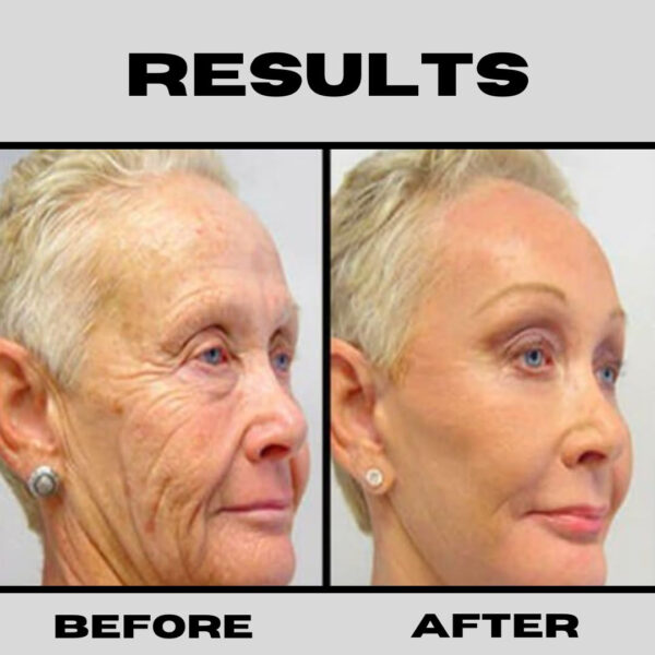 68931e3e0c749c65f10d6199dd72c8fe5199428bffc33987b2723.jpg Retinol + Niacinamide B3, Vitamin C, Hyaluronic Acid Serum, Anti-Aging Serum for face, Brightening Firming Hydrating Serum, Fine lines and Wrinkle Face Serum - 8oz