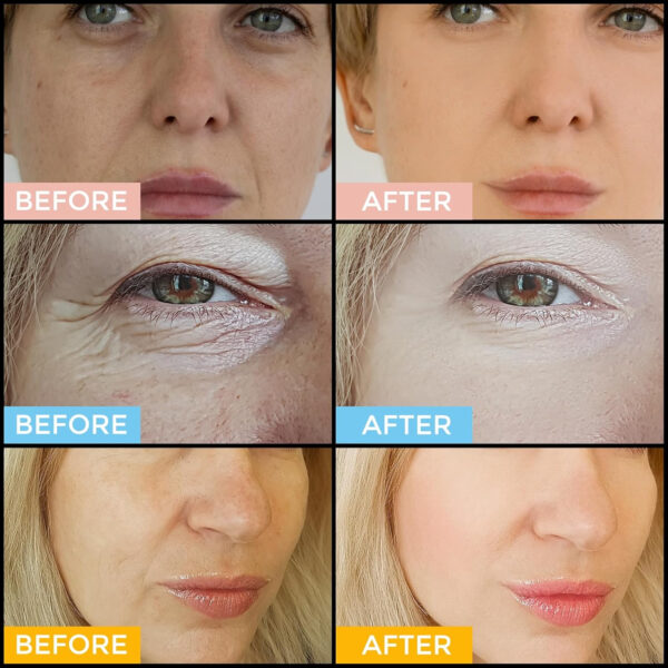 Retinol Serum for Face 2.5%, B5 Resurfacing Retinol Serum with Vitamin C, Vitamin E, Hyaluronic Acid, Niacinamide, Peptide for Anti-Aging, Wrinkle Smoothing, Dark Spot Corrector, Brighten Dullness