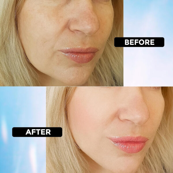 Retinol Serum for Face 2.5%, B5 Resurfacing Retinol Serum with Vitamin C, Vitamin E, Hyaluronic Acid, Niacinamide, Peptide for Anti-Aging, Wrinkle Smoothing, Dark Spot Corrector, Brighten Dullness