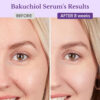 Retinol Serum for Face 2.5%, B5 Resurfacing Retinol Serum with Vitamin C, Vitamin E, Hyaluronic Acid, Niacinamide, Peptide for Anti-Aging, Wrinkle Smoothing, Dark Spot Corrector, Brighten Dullness