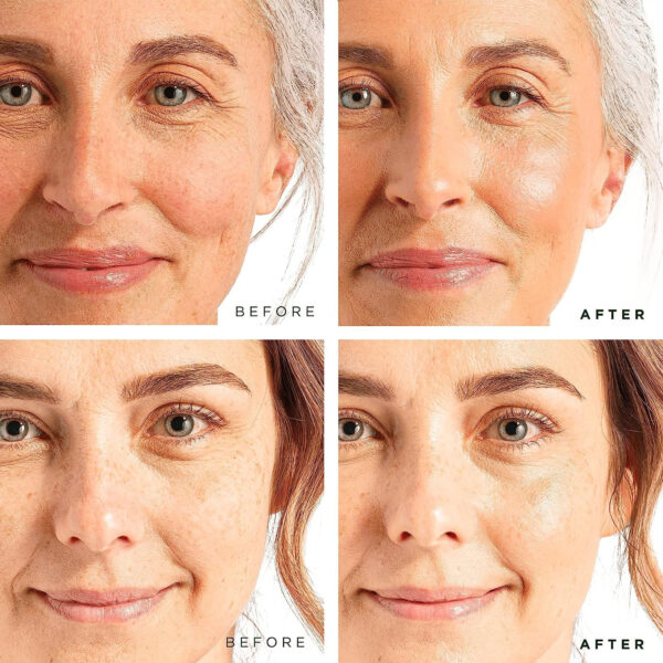 Tree of Life Beauty Facial Skin Care Set, Brightening, Firming, Hydrating, Dry Face, Dermatologist Tested - Niacinamide + Vitamin C + Retinol + Hyaluronic Acid Serum - 4 count of 1 Fl Oz