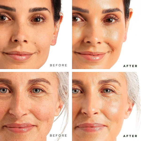 Tree of Life Beauty Facial Skin Care Set, Brightening, Firming, Hydrating, Dry Face, Dermatologist Tested - Niacinamide + Vitamin C + Retinol + Hyaluronic Acid Serum - 4 count of 1 Fl Oz