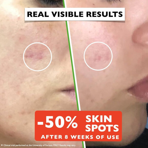 Vitamin C Serum For Face – Anti-Aging Facial Serum with Vitamin C, Hyaluronic Acid, Niacinamide, B5 & Vit E. Brightening Facial Essence for Dark Spots, Fine Lines, Wrinkles & Glowing Skin, 2 Fl Oz