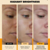 68932081e5e36e088315400db9c092c9b78517ac45cb491dee027.jpg Pure Natural Skin Brightening & Anti Aging 20% Vitamin C Serum, Collagen Peptide Infused Face Serum for Deep Hydration, All-in-One with Niacinamide, Retinol, Hyaluronic Acid, 2.02 Fl Oz