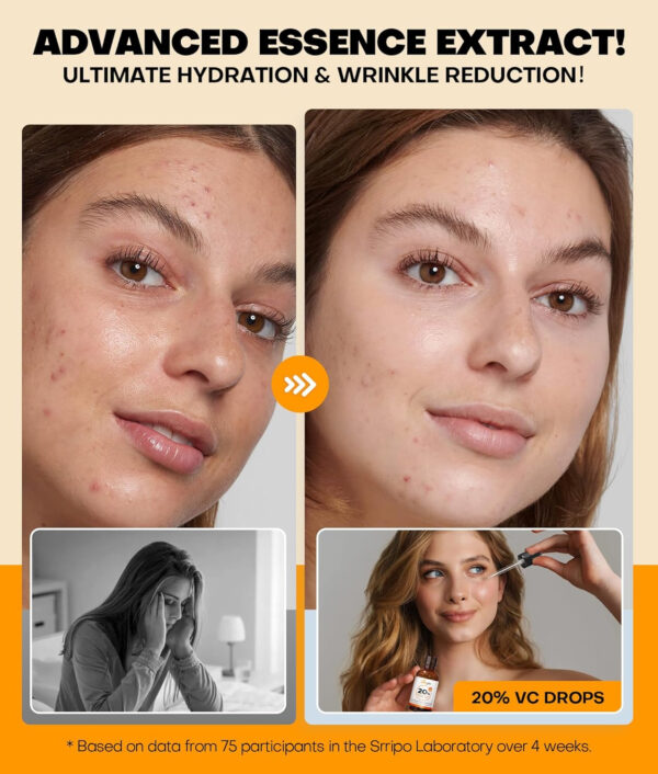 68932082e7e5304a3bbe65d428a9071c08c0246ae97e66b2c6c5d.jpg Pure Natural Skin Brightening & Anti Aging 20% Vitamin C Serum, Collagen Peptide Infused Face Serum for Deep Hydration, All-in-One with Niacinamide, Retinol, Hyaluronic Acid, 2.02 Fl Oz