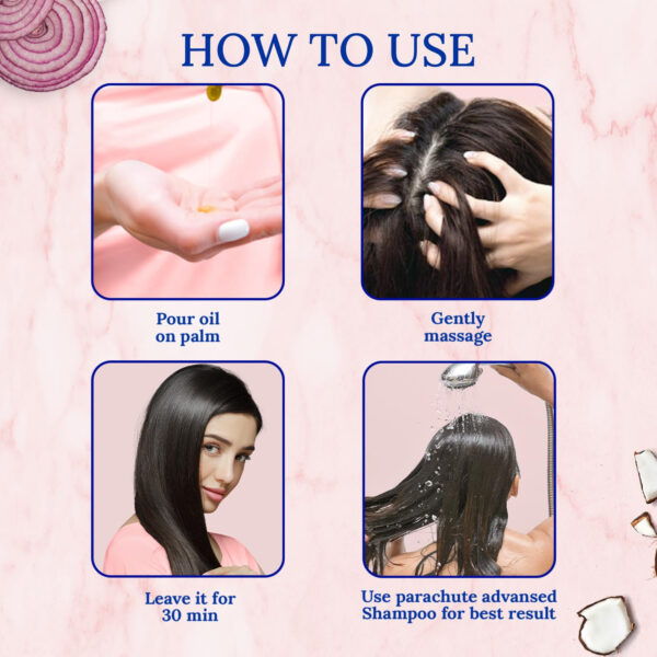 Parachute Advansed Onion Hair Oil with Natural Coconut Oil & Vitamin E, 6.7 Fl.oz. - For Longer, Stronger, Healthier Hair, Promotes Growth, Hair Fall Control, All Hair Types, Blue