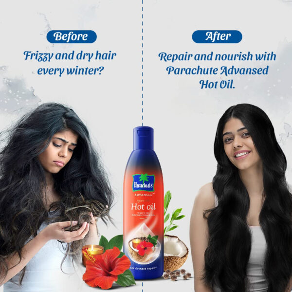Parachute Advansed Ayurvedic Coconut Hair Oil with Basil (Tulsi), Aloe vera, Flax seed, Gooseberry (Amla) |25 Ayurvedic Ingredients | Controls Hair Fall, Dandruff, Hair Thinning|6.4 Fl.oz