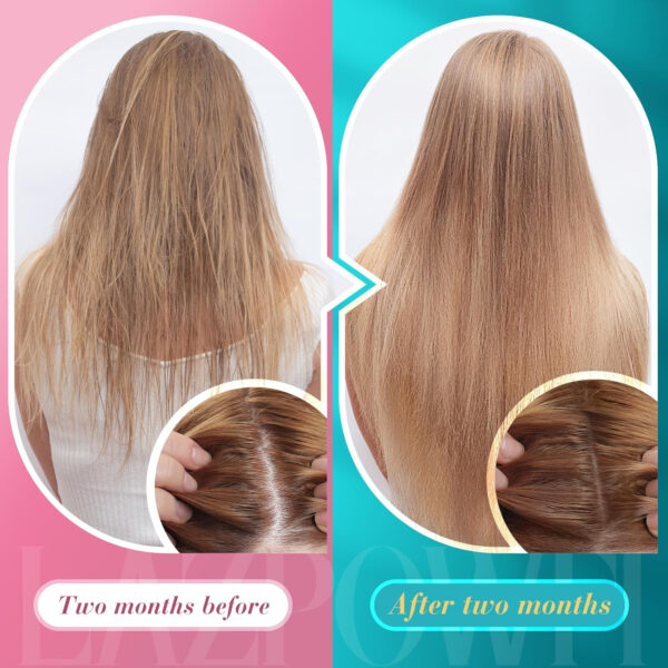 Biotin Gummies -Hair Skin and Nails Vitamins for Men & Women, Vegan Vitamin B7, Supports Hair Growth and Stronger Nails,30 Day Supply - Raspberry-60 Count