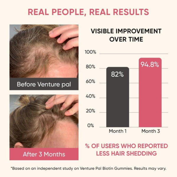 689490541c378fb25be3eb3dc3d1774e298d4b81c1cf355cee53a.jpg Venture Pal Biotin Gummies with Collagen & Keratin - Hair Growth Support Skin and Nail Strength Vitamins for Women & Men - Biotin 10000mcg | B-Complex | Saw Palmetto - Sugar Free, Non-GMO, 60ct