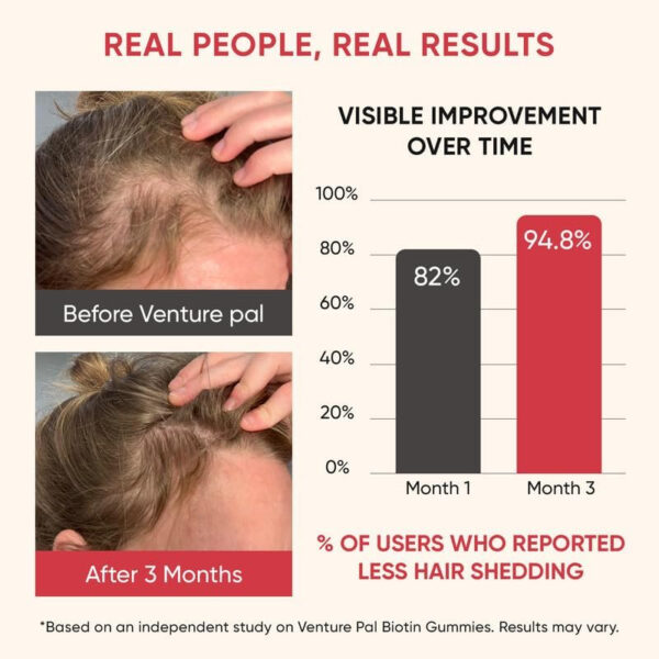6894905e235c1d4d609883385e73ca769f67c6dcc4a3331fe4ba6.jpg Venture Pal Biotin Gummies with Collagen & Keratin - Hair Growth Support Skin and Nail Strength Vitamins for Women & Men - Biotin 10000mcg | B-Complex | Saw Palmetto - Sugar Free, Non-GMO, 60ct